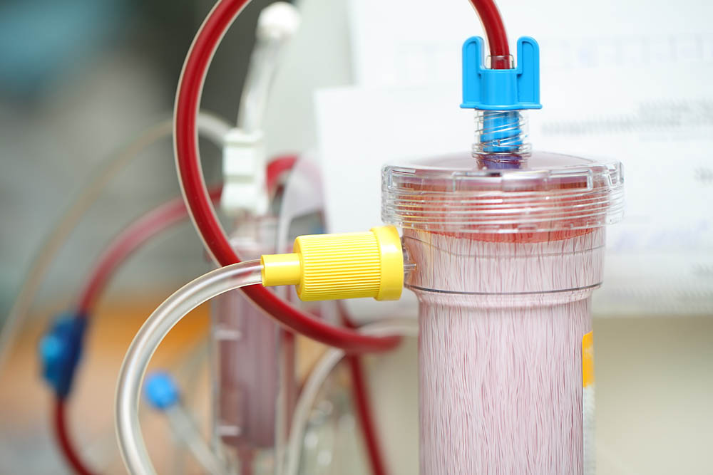 dialysefilter
